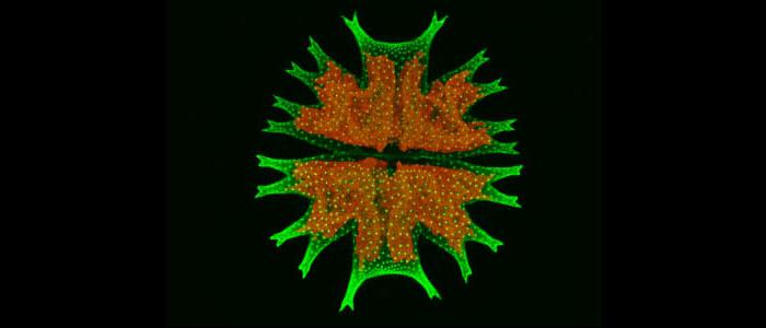 共焦激光扫描% % 20 % 20 20显微镜图像% 20 % 3 a % 20绿色% 20海藻% 2 c % 20 micrasterias